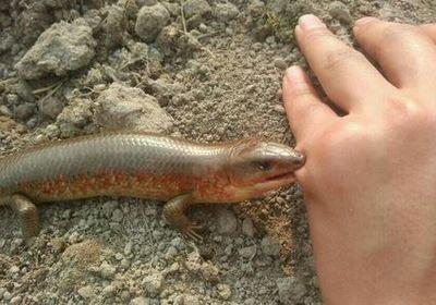   梦见手被蛇咬伤