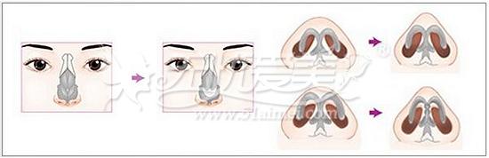 描述鼻子的句子