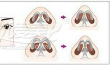 描写鼻子的句子