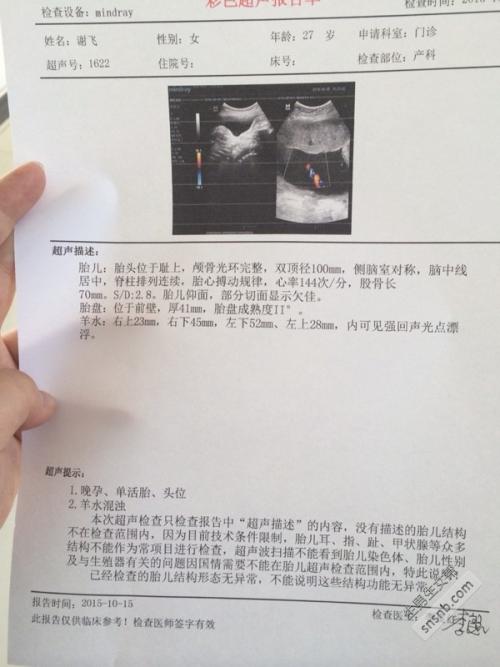 祝第二胎的女孩