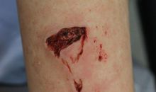 描写伤口流血的句子