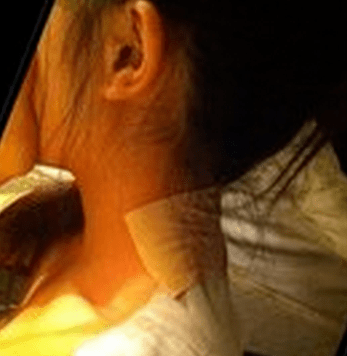 寓言在僧侣头上的虱子