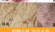 秃头上的虱子歇后语