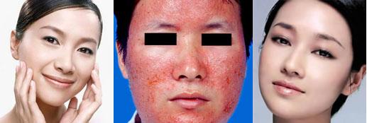 鼓励女性去雀斑的句子