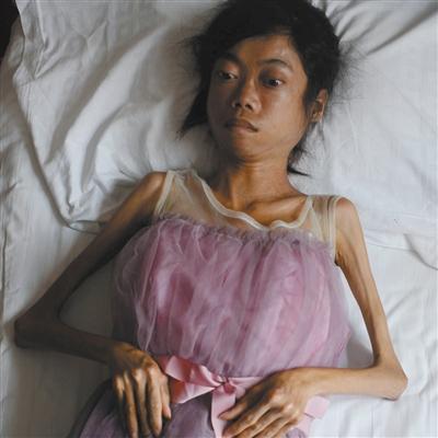 徐旭：谈论美容疾病