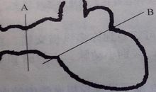 一根大头针把他送上了银行家的宝座