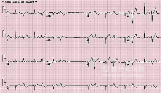 描述喜悦，愤怒，悲伤和喜悦的段落