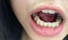 小心自己的嘴巴