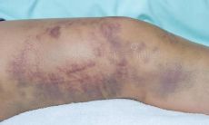 那些带着伤口的句子：每一个表达背后的痛苦和深层情感